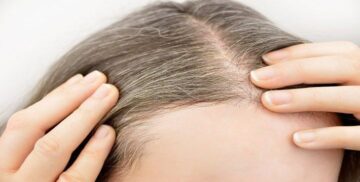 اسرع علاج الشيب نهائيا مجرب بوصفة مغربية تحتوي على فيتامين سي تقضي على شيب الشعر