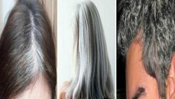 أسباب وطرق علاج ظهور الشعر الأبيض عند الرجال والنساء