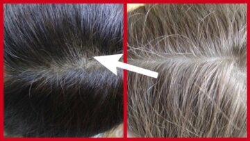 وصفات لعلاج شيب الشعر والتخلص من الشعر الأبيض وزيادة إنتاج الميلانين