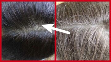 وصفات لعلاج شيب الشعر وزيادة إنتاج مادة الميلانين دون استخدام الصبغات 