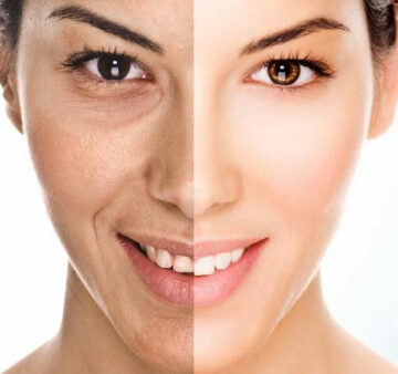 علاج تجاعيد الوجه والتخلص من علامات الشيخوخة المبكرة بهذه الوصفة السحرية الفعالة