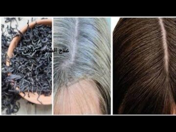 أسرع علاج الشعر الابيض نهائيا مجرب وصفة سريعة لأجل التخلص منه واستبدال الشعر الشايب بالأسود